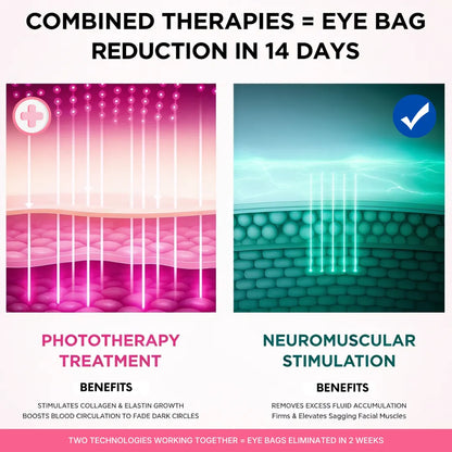 RevitalEyes® Dual Red Light Therapy + EMS To Erase Eye Bags