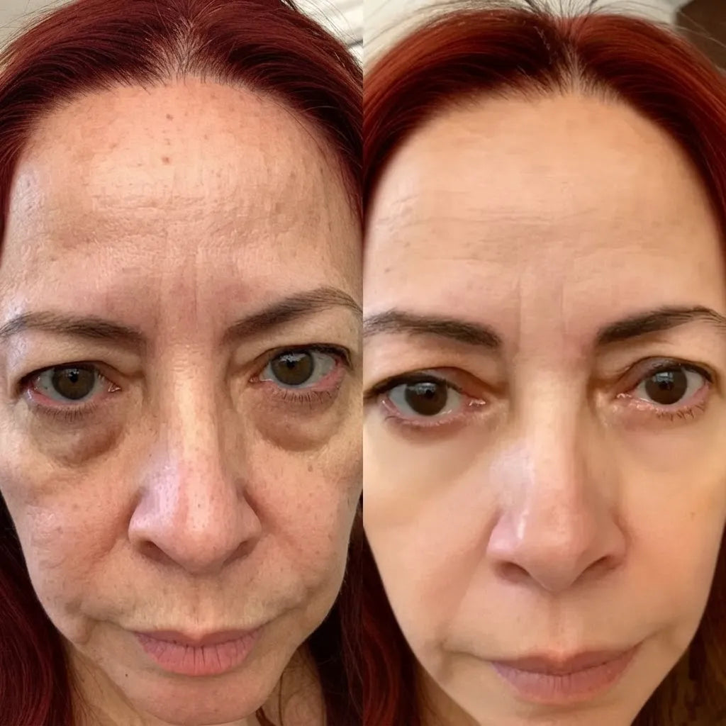 RevitalEyes® Dual Red Light Therapy + EMS To Erase Eye Bags